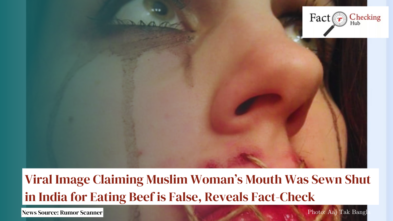 Viral Image Claiming Muslim Woman’s Mouth Was Sewn Shut in India for Eating Beef is False, Reveals Fact-Check